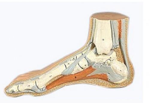 leg.jpg